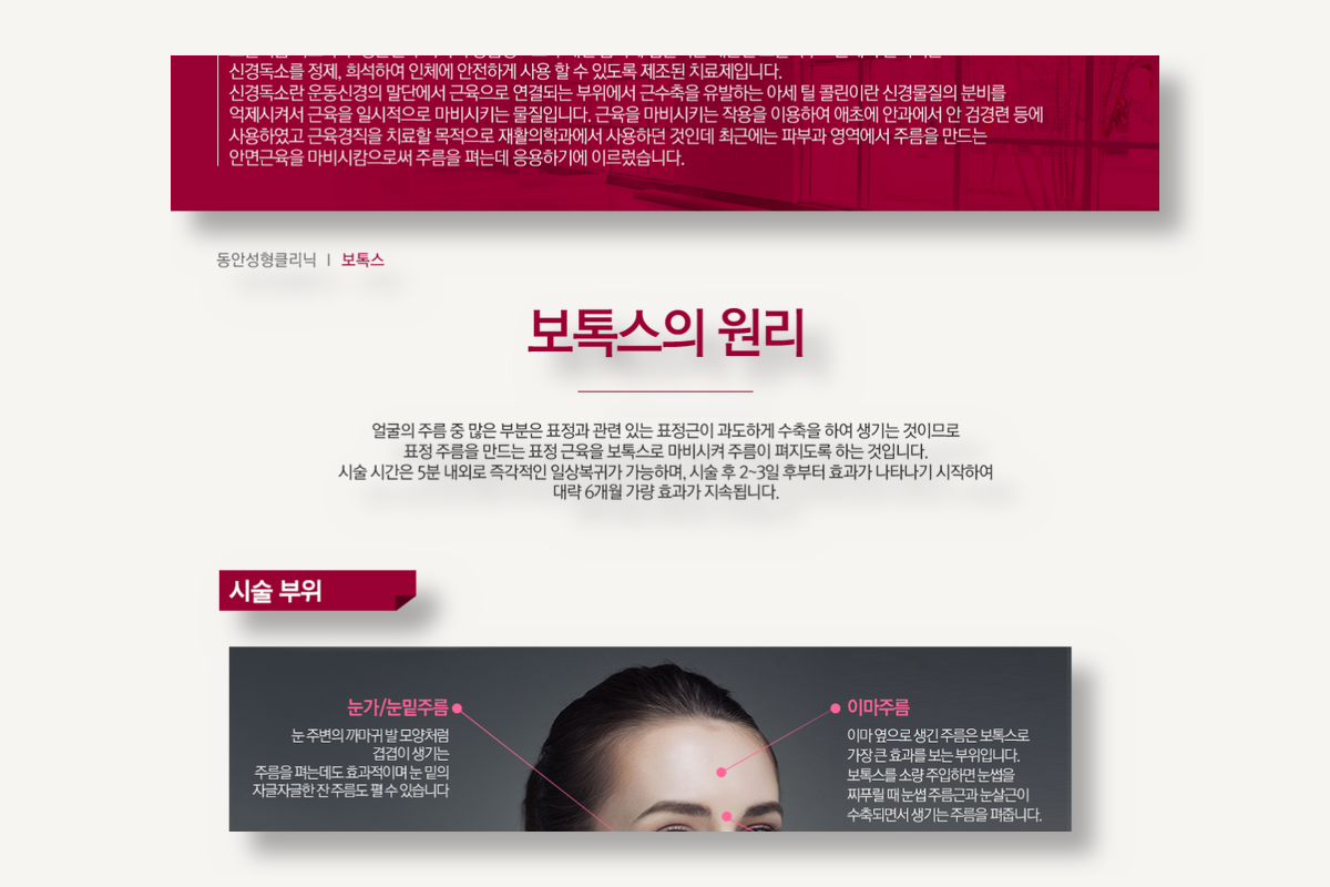 보톡스