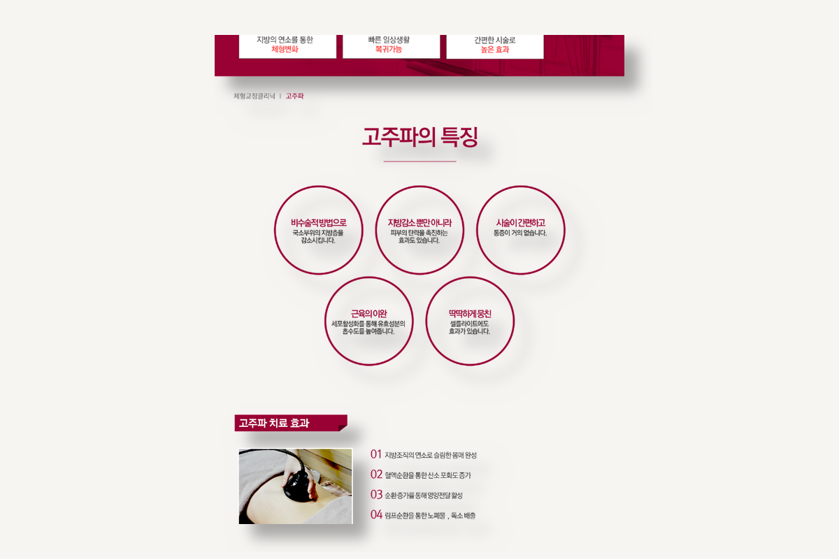 고주파 치료