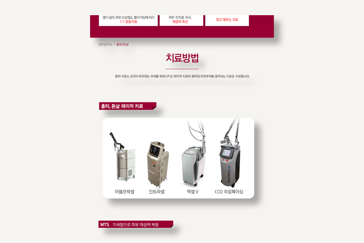 흉터/튼살 치료