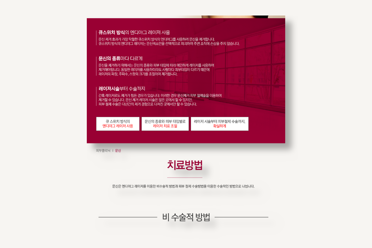 문신제거